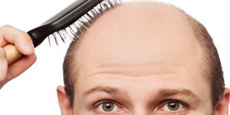 Saç dökülmesine karşı doğal yöntemler